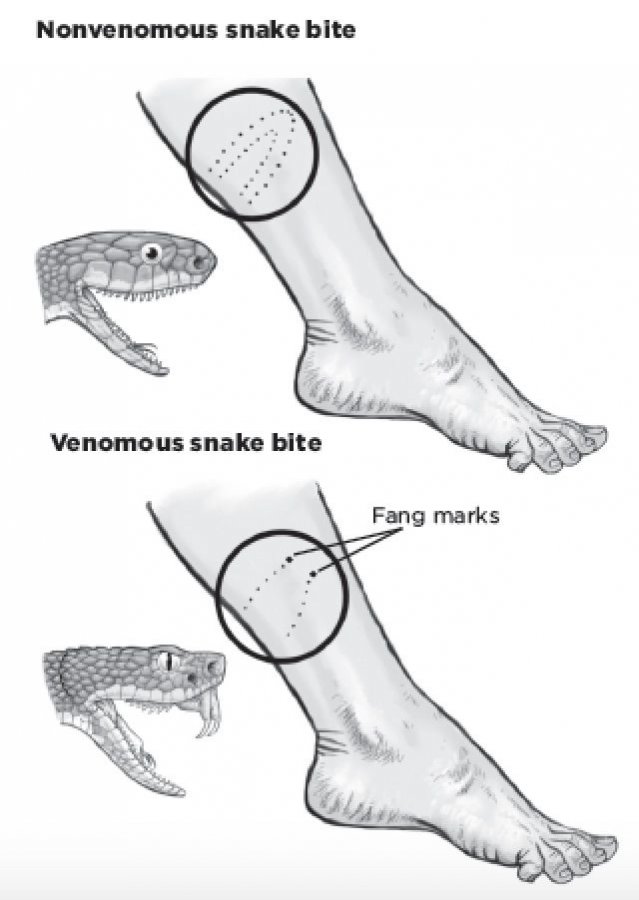 How to Identify a Venomous Snake By Its Bite  You_re camping and need to start a fire, so you ...jpg