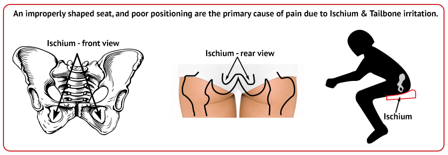 ischium-diagram-wide.png