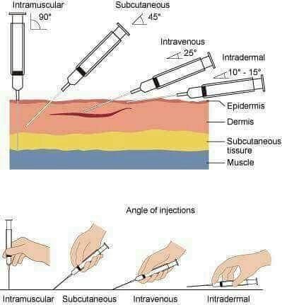 paramedicsworld_  _#People #pain #learn #life #lessons #injections #syringe #biology #science ...jpg