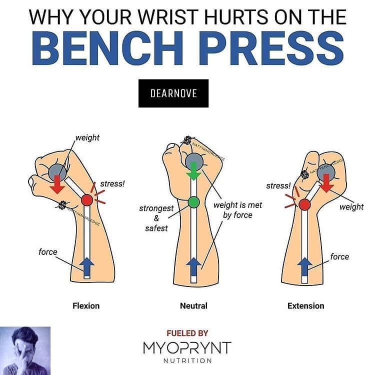 ____________ ________________ ______ __________ ________________ -  Wrist pain is common, espe...jpg