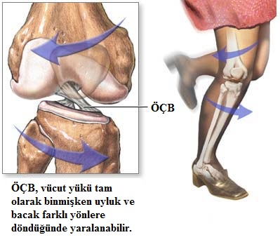 aclinjury.jpg