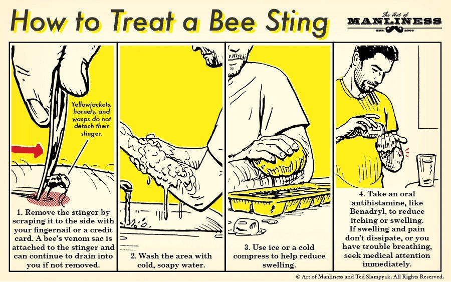 If you **** yourself at the business end of an angry stinger, follow these steps to neutralize...jpg