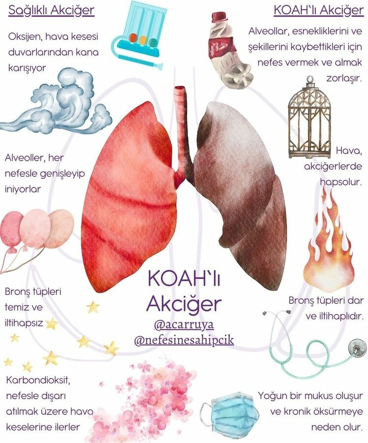 More about this Pin 3 Likes 1 Share Board containing this Pin saglik 1.5k Pins 3w.jpg