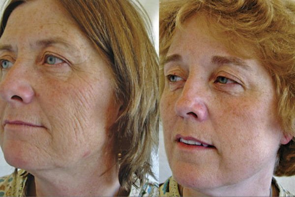smoking-age-the-faces-of-identical-twins-7.jpg