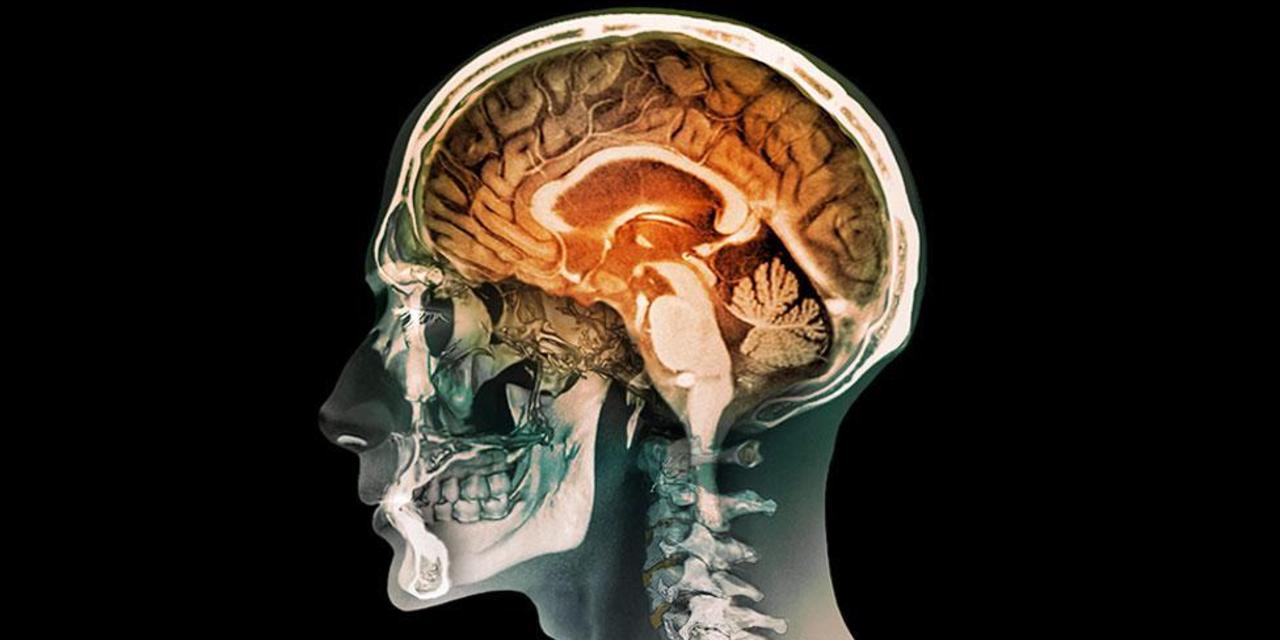 insan-beyni-üretildi.jpg